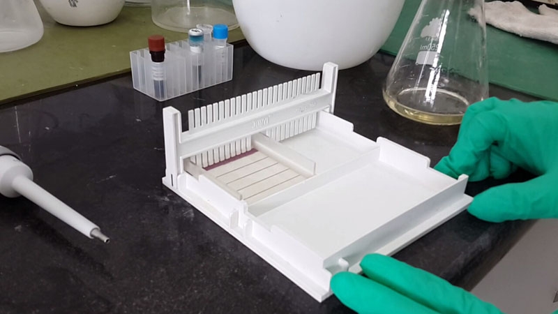 琼脂糖凝胶电泳-1-1%琼脂糖凝胶配制